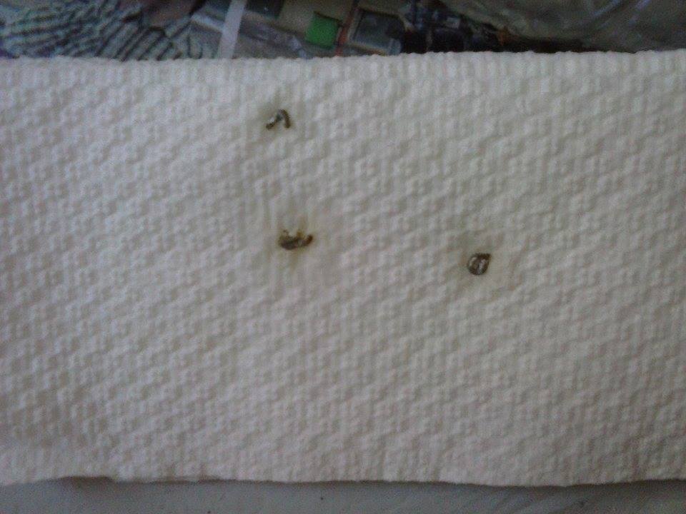 Poliuria?