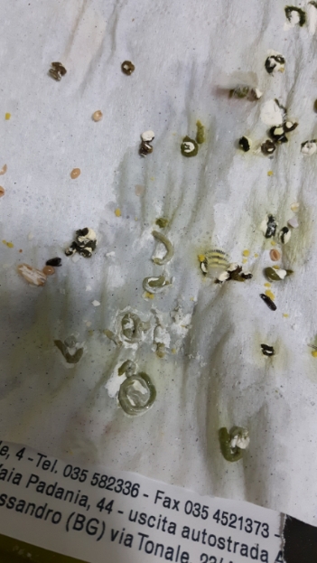 Poliuria?