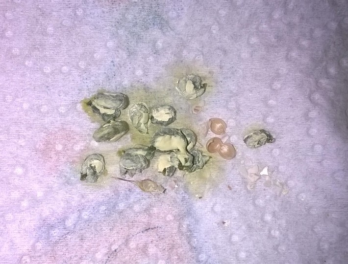 Poliuria?